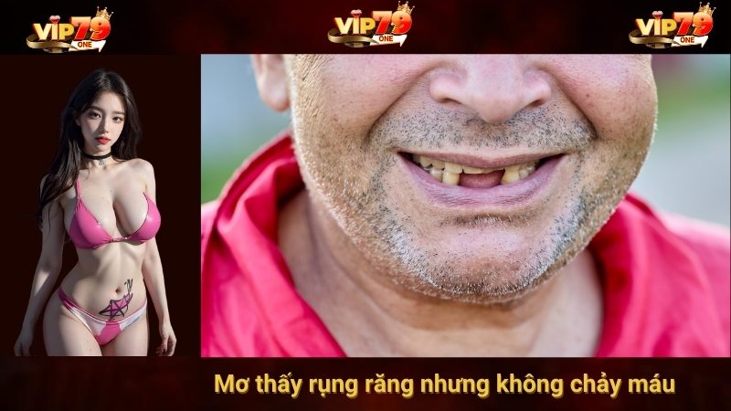 Mơ rụng răng không chảy máu 